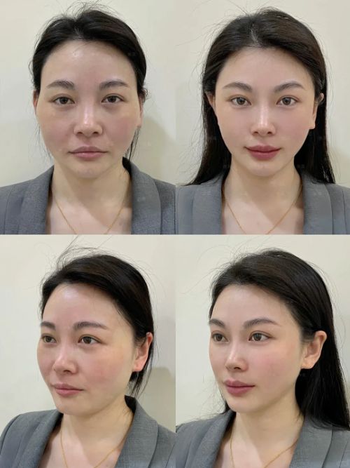 50岁抗皱紧致十大品牌给你紧致肌肤AG真人直营抗衰老的护肤品排行榜